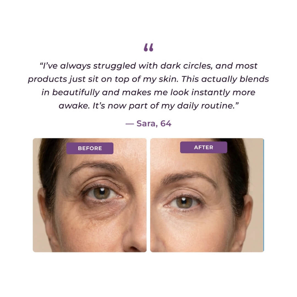 EyeCorrect™ Brightener