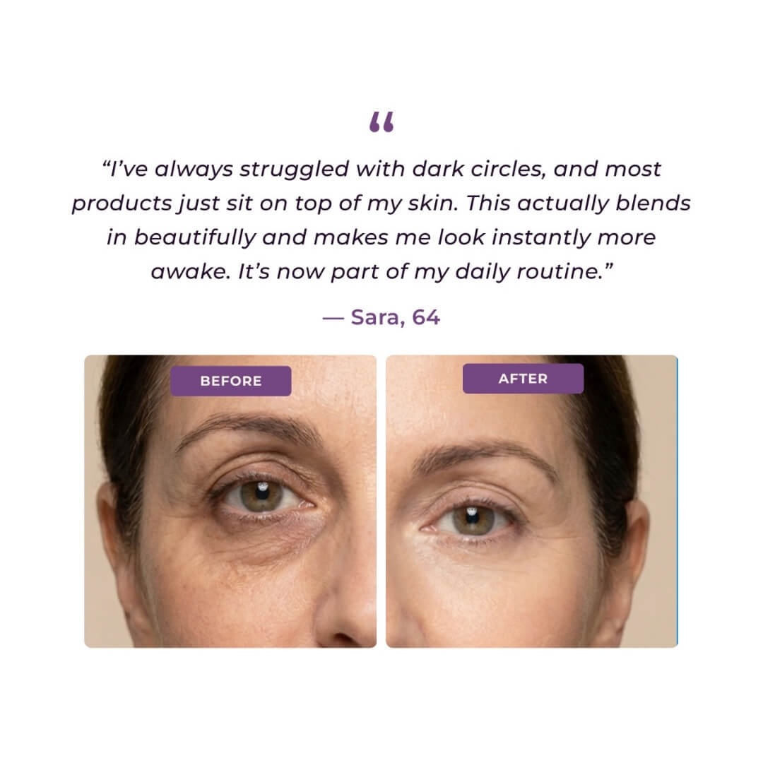 EyeCorrect™ Brightener