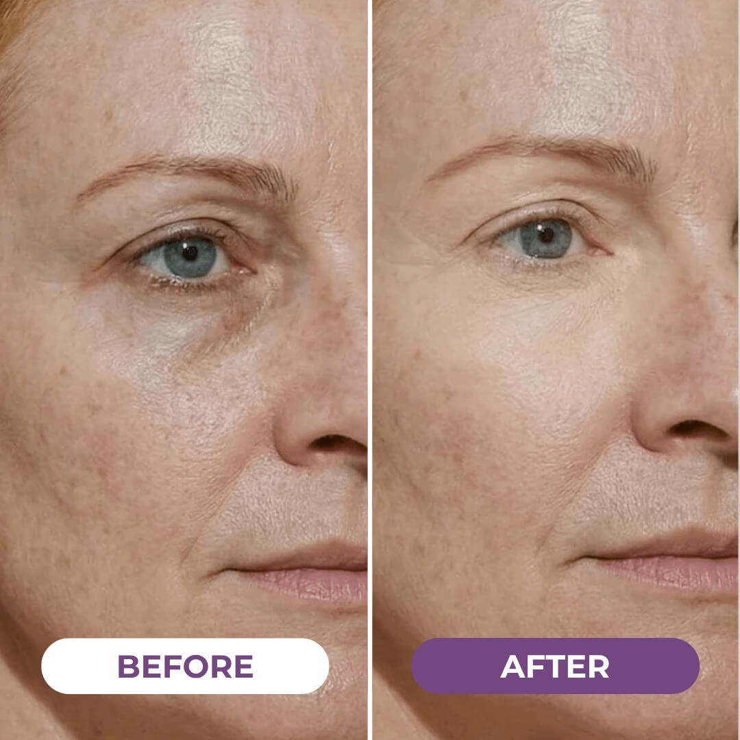 EyeCorrect™ Brightener